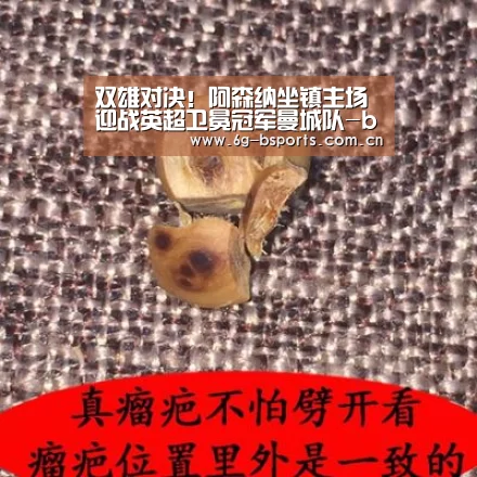 双雄对决!阿森纳坐镇主场迎战英超卫冕冠军曼城队-b体育网站(图4) b体育官方下载